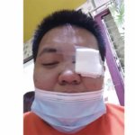 菲律宾狗狗误伤主人，竟导致主人眼角膜破裂，结局却意外暖心479